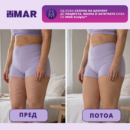 IMAR Sculpta™ - Уред за затегнување и обликување на телото